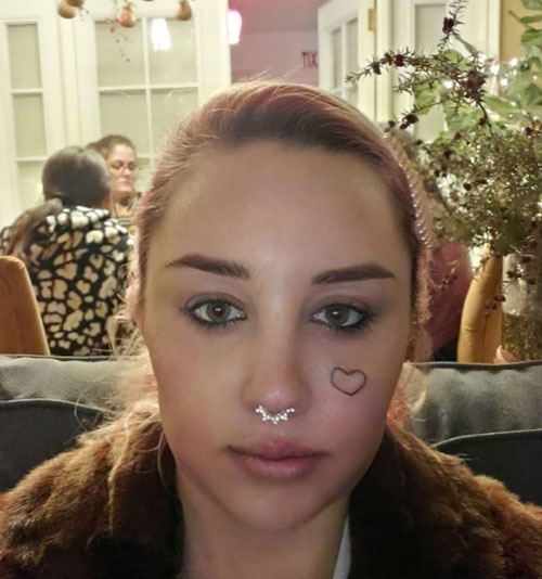 How Amanda Bynes looks today